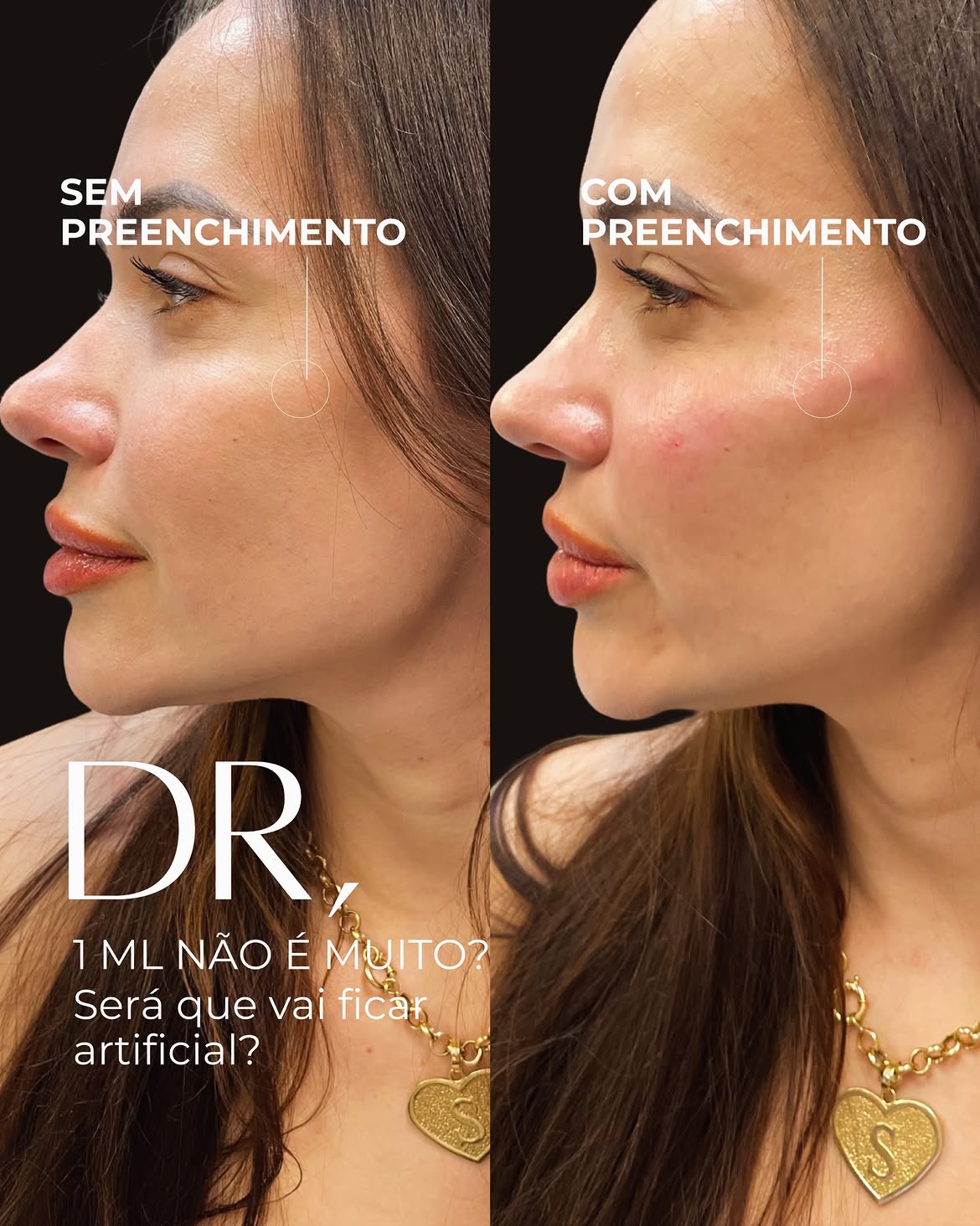 Antes e Depois 2